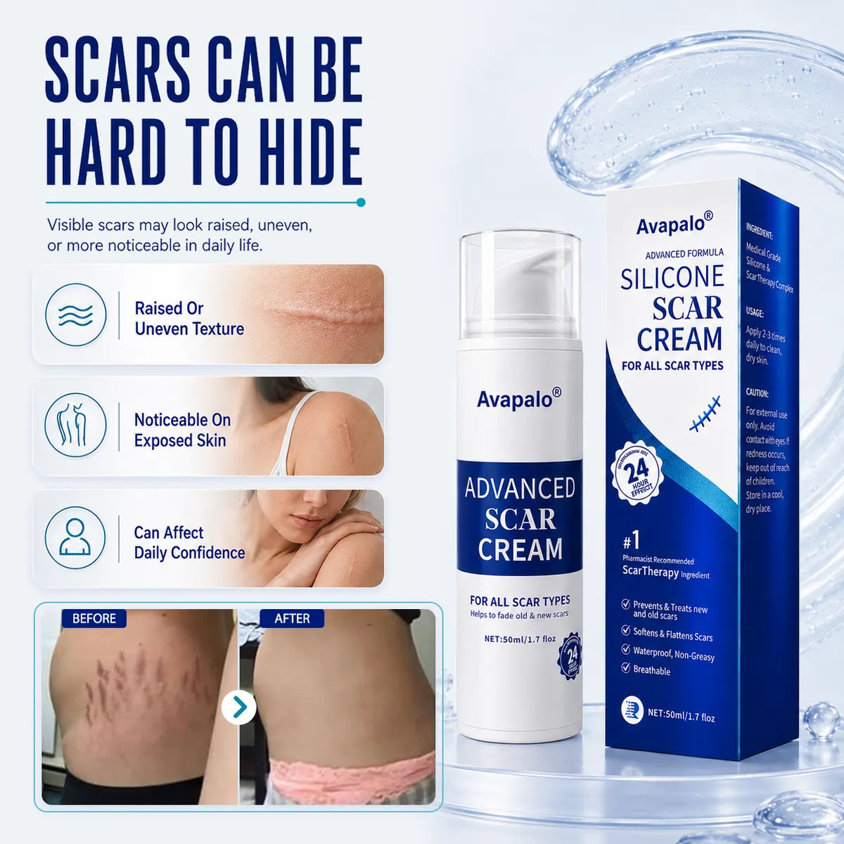 Avapalo® Advanced Silicone Scar Gel – Professional Scar Removal Cream for Surgical Scars, Keloids, Stretch Marks, C-Section & Old or New Scars Repair Treatment